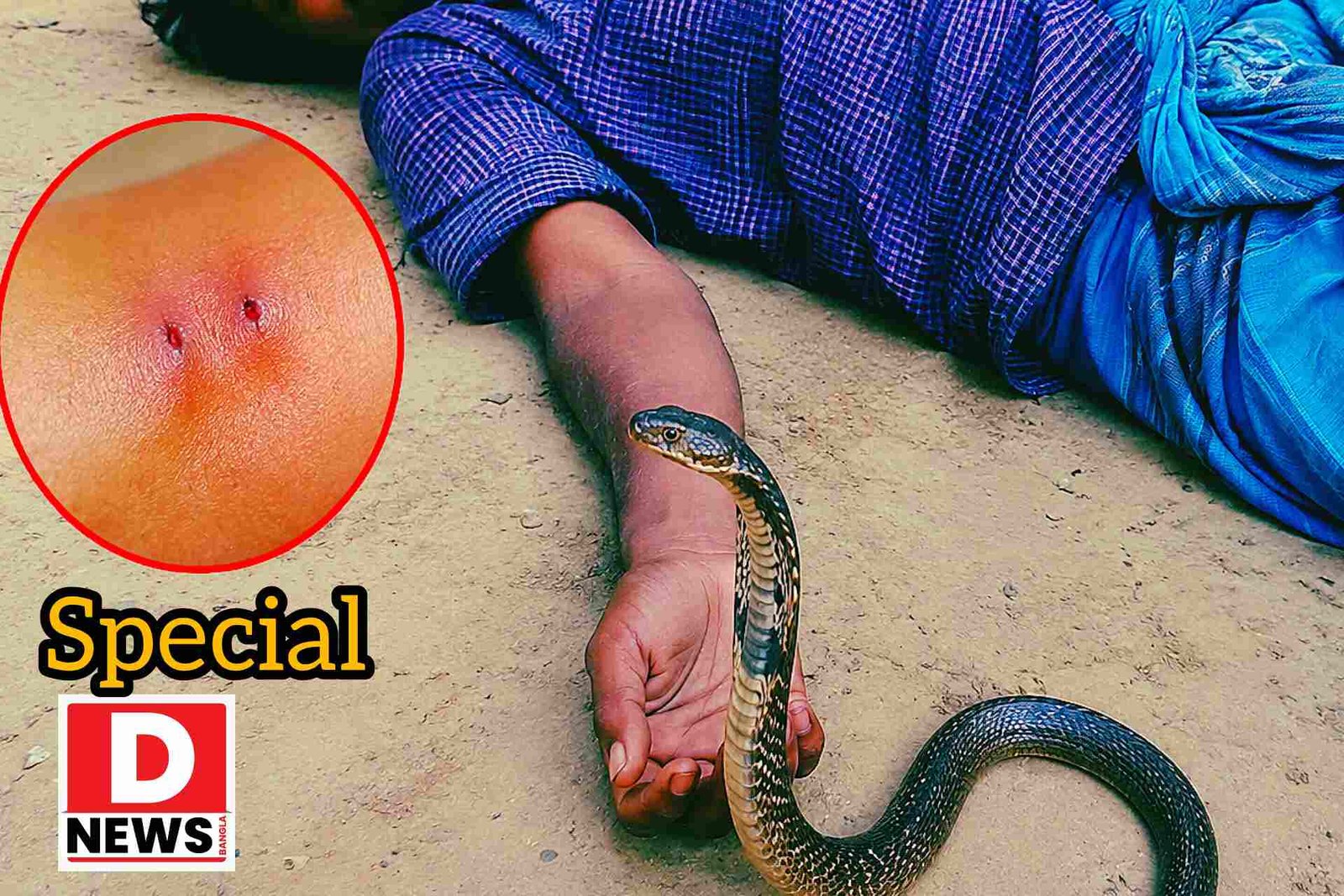 Sneke Bite : সাপে কাটার ‘গোল্ডেন পিরিয়ড 100 মিনিটে’ ওঝা গুনিনের দ্বারস্থ হওয়ার জন্যই ঘটছে মৃত্যু!জল বন্যায় বিধ্বস্ত মেদিনীপুরে 1200 সাপে কাটা রোগী
